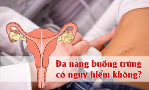 Buồng trứng đa nang có nguy hiểm không