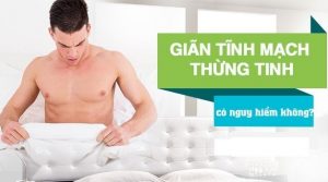 Bệnh giãn tĩnh mạch thừng tinh là gì