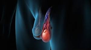 Bệnh giãn tĩnh mạch tinh hoàn có chữa khỏi không