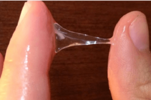 Bệnh huyết trắng có nguy hiểm không