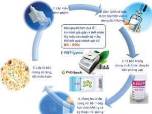 Các xét nghiệm tầm soát ung thư cổ tử cung