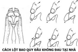 Cách chữa hẹp bao quy đầu tại nhà bằng tay ( có minh họa ) !