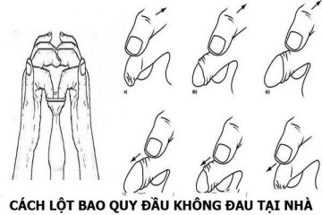 Cách chữa hẹp bao quy đầu tại nhà bằng tay ( có minh họa ) !