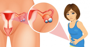 U nang buồng trứng có nguy hiểm không