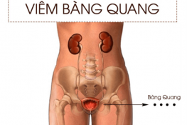 [ Viêm bàng quang ] : Nguyên nhân , triệu chứng và cách chữa