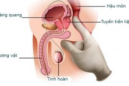 Viêm tuyến tiền liệt có chữa được không , tự khỏi không ?