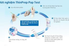 [ Giải đáp ] : Xét nghiệm ung thư cổ tử cung như thế nào ?