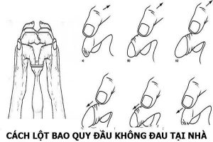 Cách lột bao quy đầu