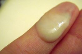 [ Khí hư màu vàng đặc dính là bệnh gì ? ] Có nguy hiểm không ?