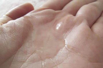 [ Khí hư ra nhiều loãng như nước là bệnh gì ] : Phải làm sao ?