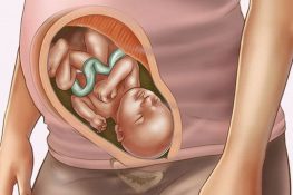 [ Thai 36 tuần ] : Đau bụng lâm râm có sao không , chỉ số thai !