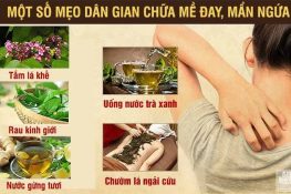 [ Bật mí ] 9 Cách chữa nổi mề đay dân gian đơn giản , hiệu quả !