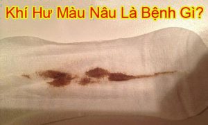 Khí hư màu nâu đen