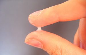 khí hư màu trắng đục và ngứa