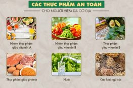 [ Viêm da cơ địa nên ăn gì và kiêng ăn gì ] 5 Loại thực phẩm tốt !