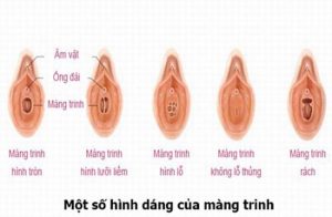 Mất trinh có sao không