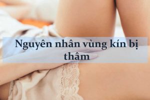 nguyên nhân vùng kín bị thâm