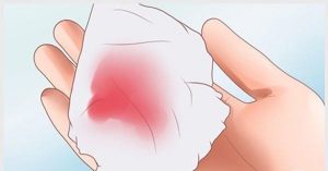 quan hệ ra máu