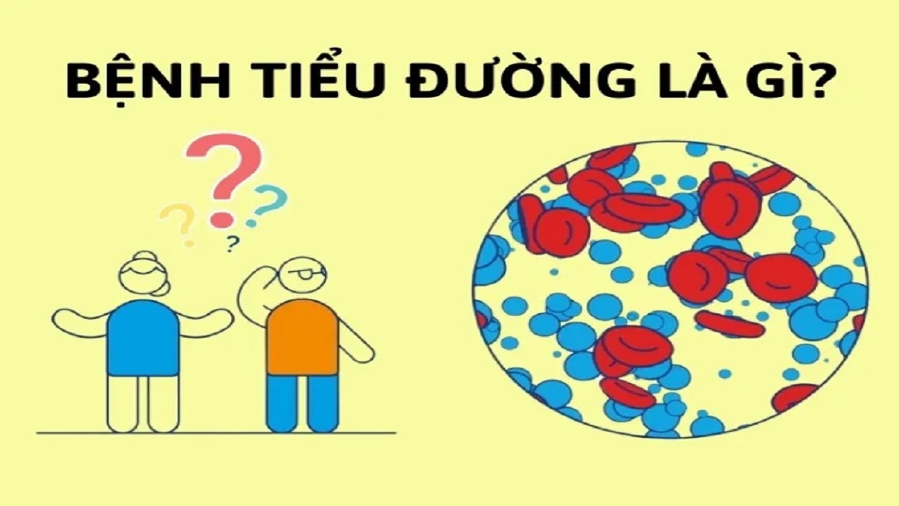 benh-tieu-duong-la-gi-750x563