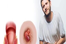 Bệnh Trĩ Là Gì? Dấu Hiệu Nhận Biết và Cách Xử Lý Hiệu Quả Nhất