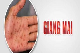Bệnh Giang Mai Là Gì? Dấu Hiệu Nhận Biết Và Cách Phòng Chống Hiệu Quả