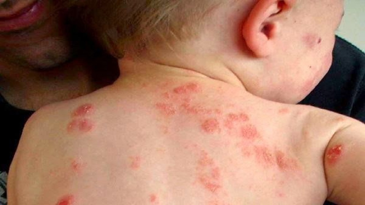 noi-man-do-khap-nguoi