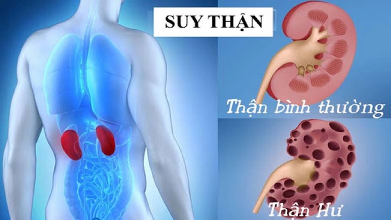 suy thận-1