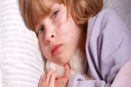 Da Nổi Mẩn Đỏ Ngứa: Nguyên Nhân và Cách Xử Lý