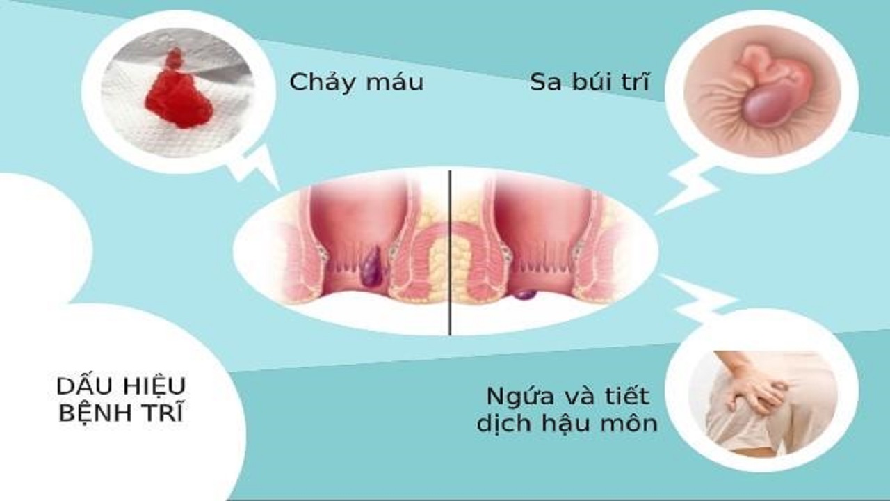 tri