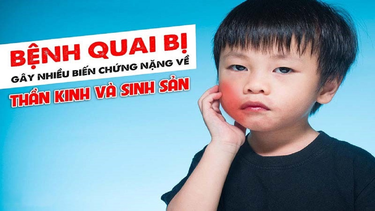 quai bị là gì