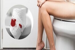 Đi Ngoài Ra Máu Tươi: Khi Nào Bạn Cần Gặp Bác Sĩ?