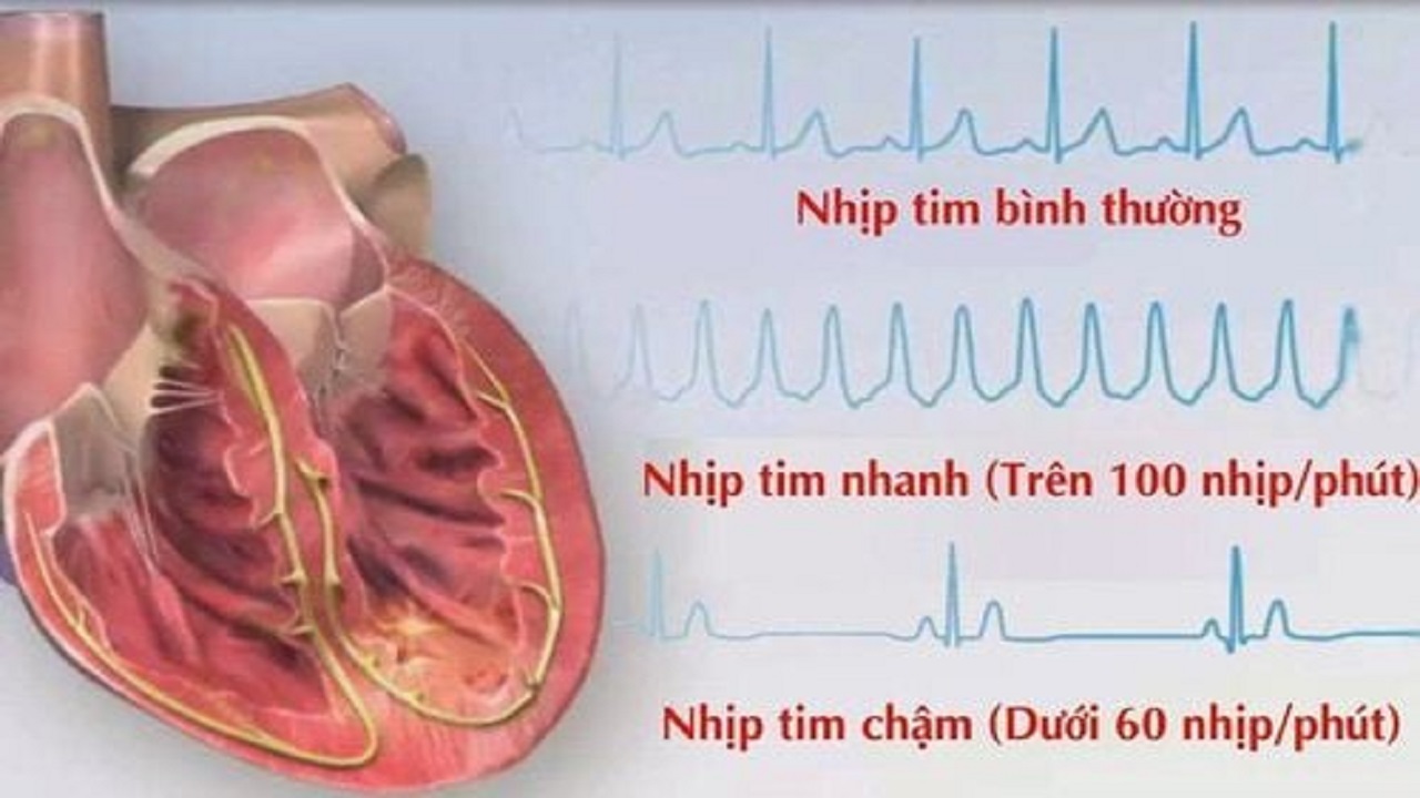 nhịp tim bình thường
