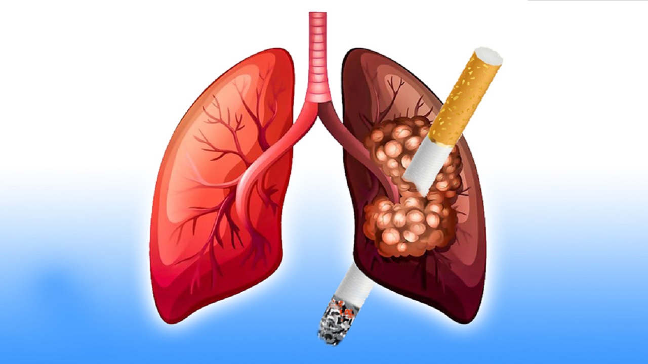 tác hại của thuốc lá