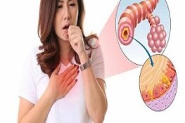 Viêm Phế Quản: Tất Tần Tật Về Nguyên Nhân, Triệu Chứng Và Cách Điều Trị Hiệu Quả