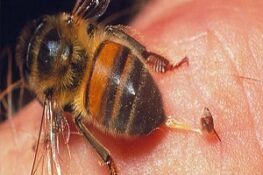 Bị Ong Đốt? Hướng Dẫn Cách Xử Lý Đúng Cách và Phòng Ngừa Hậu Quả
