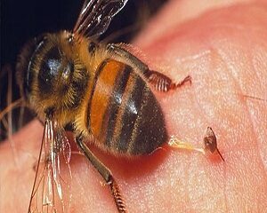 Bị Ong Đốt? Hướng Dẫn Cách Xử Lý Đúng Cách và Phòng Ngừa Hậu Quả