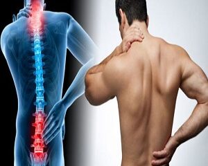 Đau Cổ Vai Gáy: Những Điều Bạn Cần Biết Để Được Chẩn Đoán Và Điều Trị Chính Xác