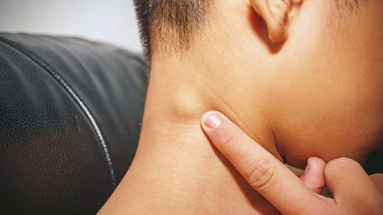 dấu hiệu hiv