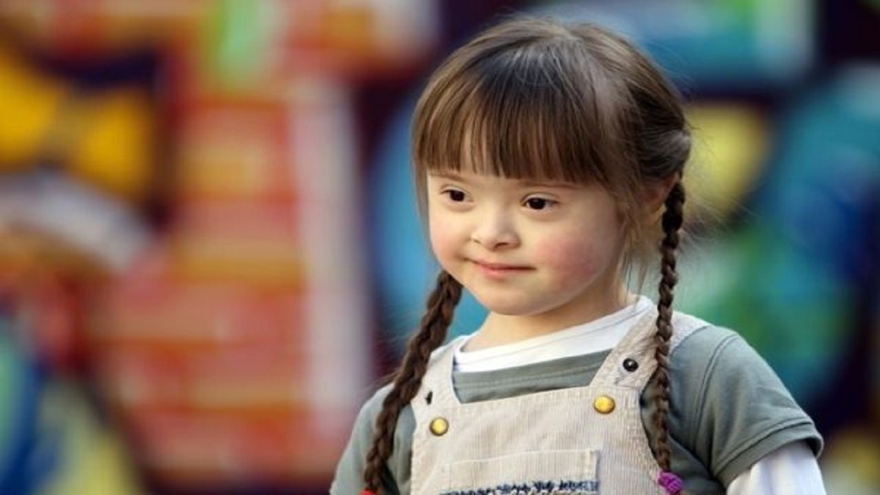 hội chứng siêu nữ