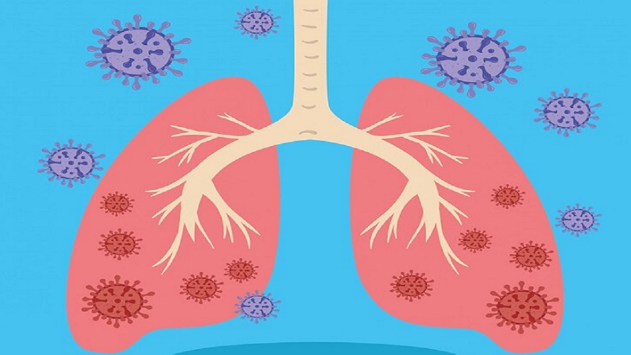 phù phổi cấp là gì