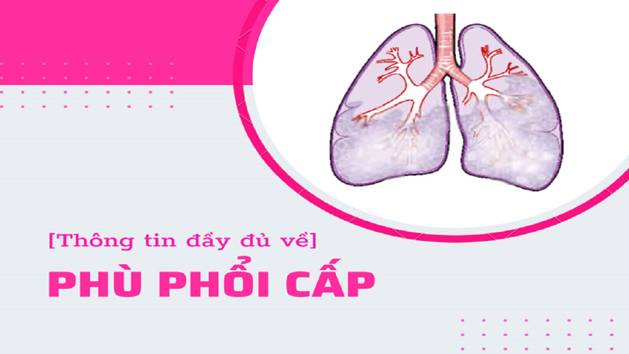 phù phổi cấp là gì