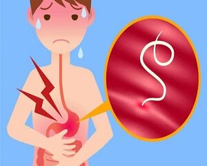 Hướng Dẫn Uống Thuốc Xổ Giun: Thời Gian Và Liều Lượng