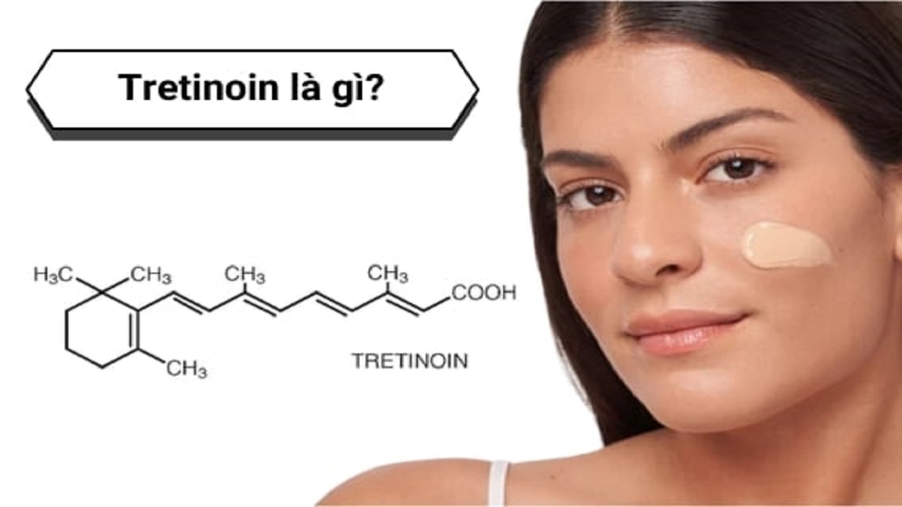 tretinoin