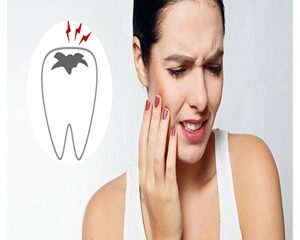 Giải Quyết Cơn Đau Răng: Nguyên Nhân và Cách Phòng Tránh Hiệu Quả