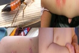 Kiến Ba Khoang Cắn Có Nguy Hiểm Không? Những Điều Bạn Cần Biết