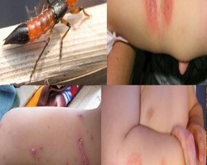 Kiến Ba Khoang Cắn Có Nguy Hiểm Không? Những Điều Bạn Cần Biết