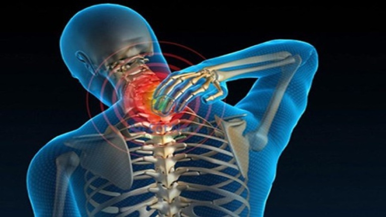 thoái hóa đốt sống cổ