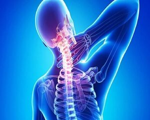 Thoái Hóa Cột Sống Cổ: Những Điều Bạn Cần Biết về Nguyên Nhân và Điều Trị
