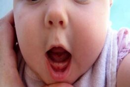 ​ ​Trẻ Mấy Tháng Mọc Răng: Những Điều Cần Biết Về Quá Trình Phát Triển Răng Miệng