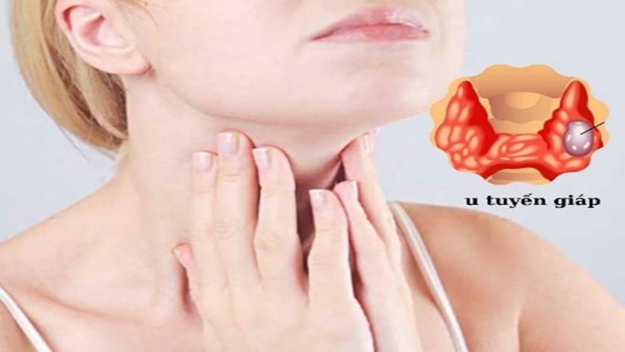 tuyến giáp là gì